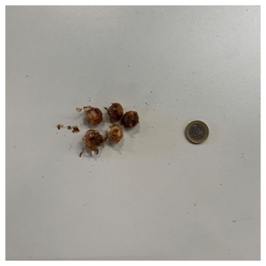 Crocus tommasinianus